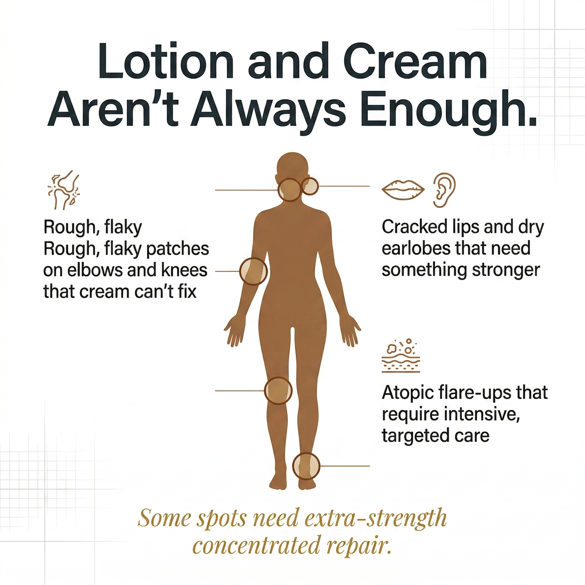 Mongdies Baby Ato Balm 30g | 100-Hour Moisture | 3-Layer Skin Repair | Portable Intensive Care